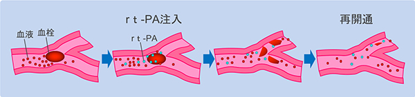 治療後の日常生活