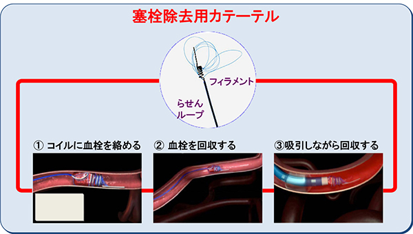 治療後の日常生活