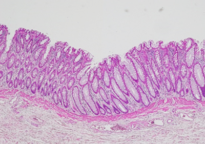 大腸の組織標本(HE染色)